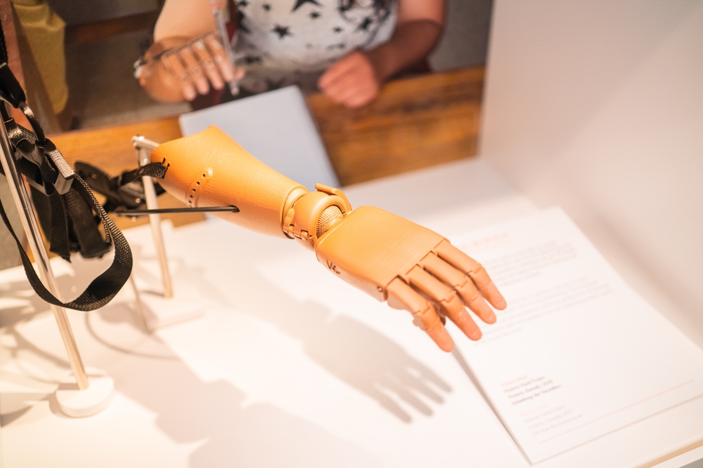 3D Scanning in Medical Industry - A Prosthetic Hand.